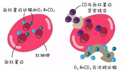 警惕洗澡季隐形杀手 一氧化碳中毒康复后，当心迟发性脑病